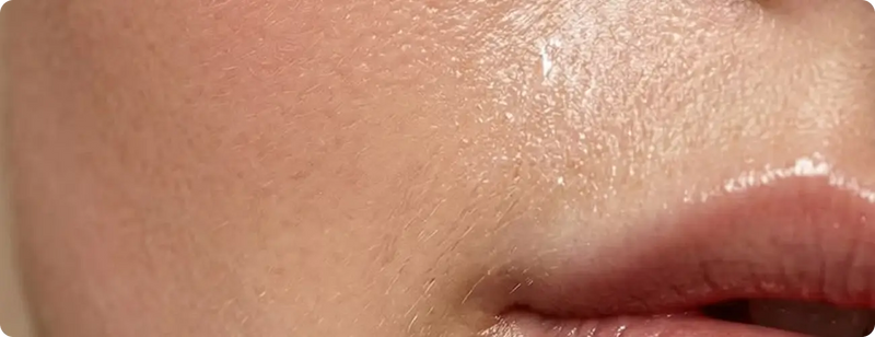 For Healthy Skin